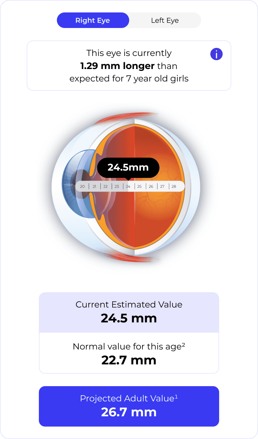 Axial Length Estimation