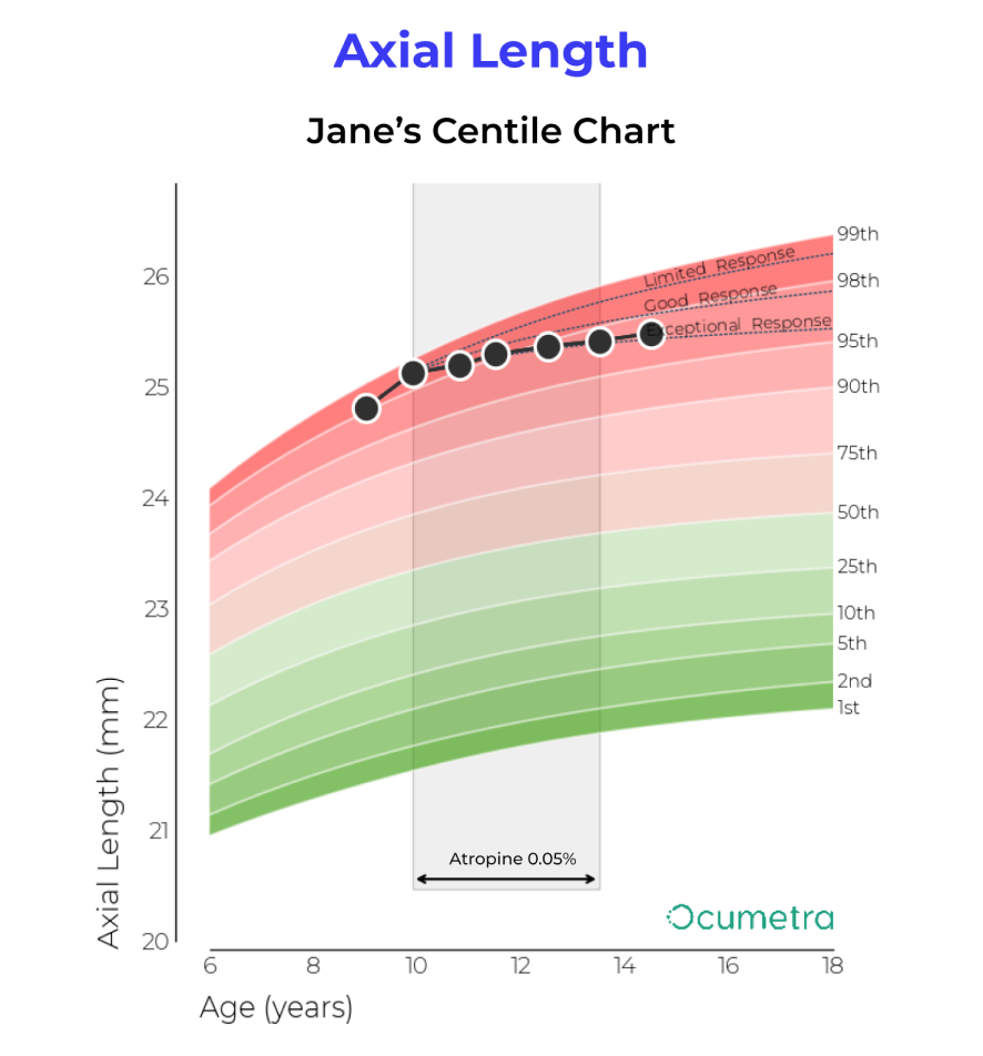 Axial Length