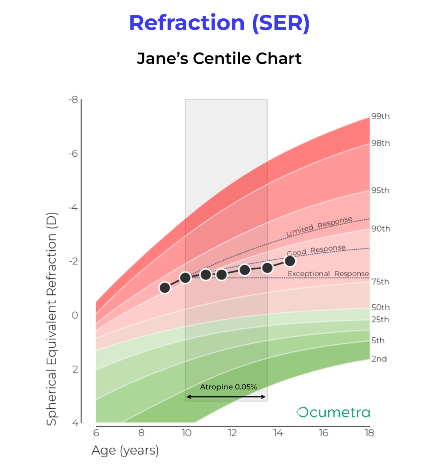 Refraction